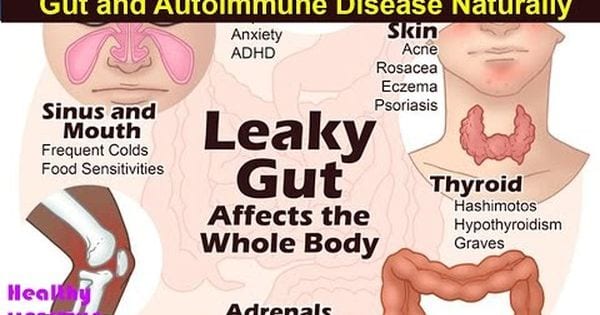6 Steps to Heal Leaky Gut and Autoimmune Disease Naturally