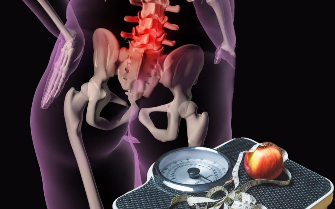 Weight Loss: Back Pain & Obesity