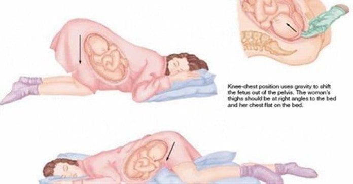 Las mejores posiciones para dormir embarazada