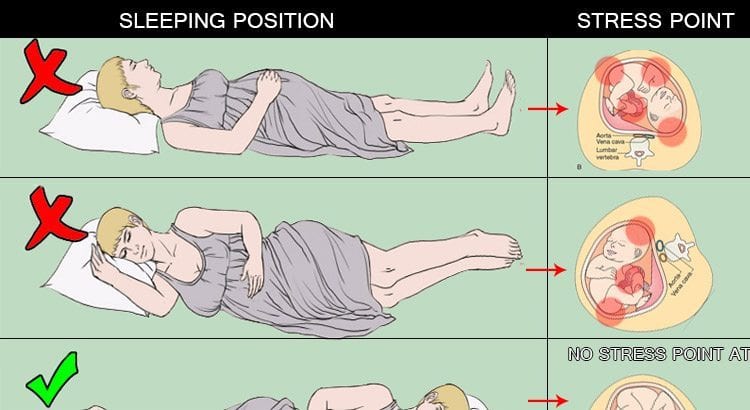 Sleeping Position During Pregnancy With Pictures El Paso Back Clinic 