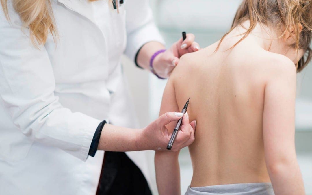 The Different Types of Scoliosis & Their Causes