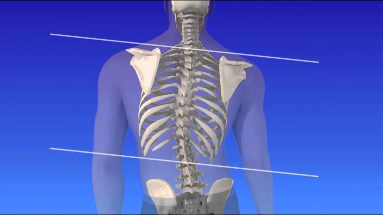 risk-factors-in-the-progression-of-scoliosis-el-paso-back-clinic