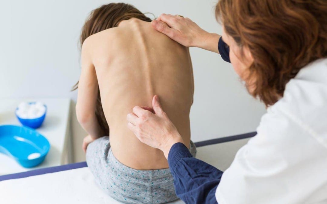 Risk Factors in the Progression of Scoliosis - El Paso Chiropractor