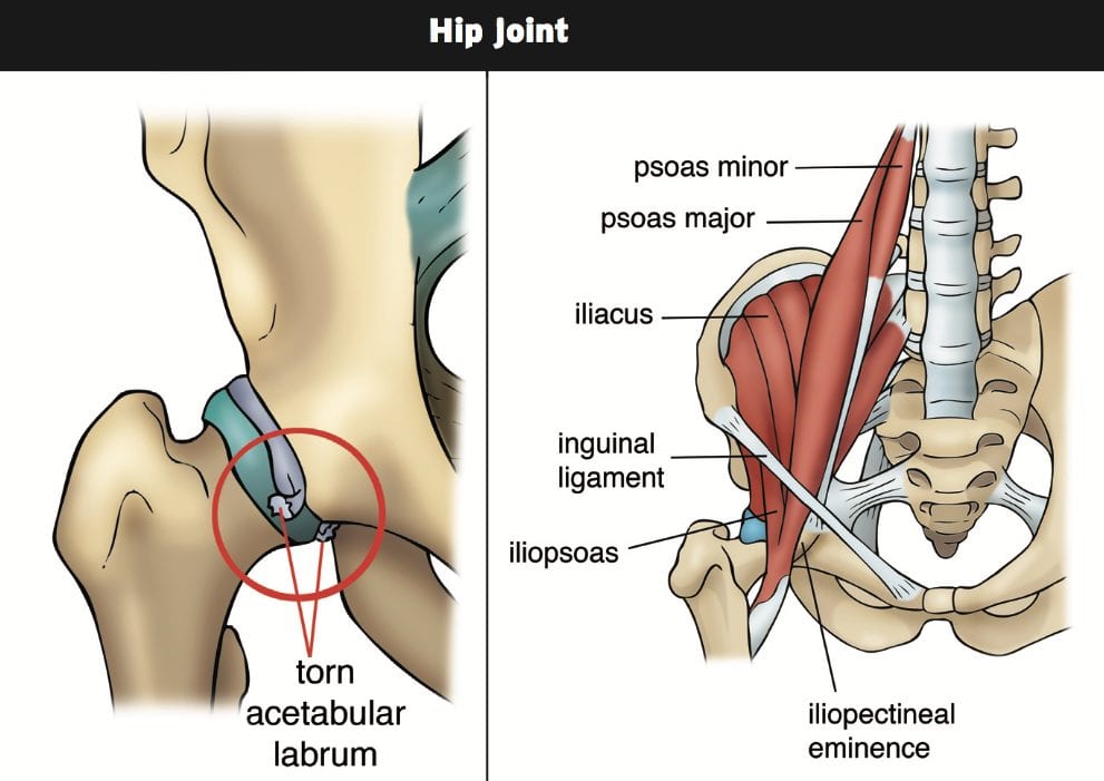 hip pain chiropractic treatment el paso tx.