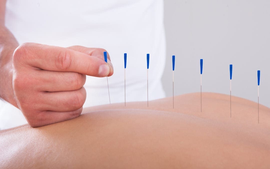 Complementary and Alternative Medicines for Chronic Pain |
