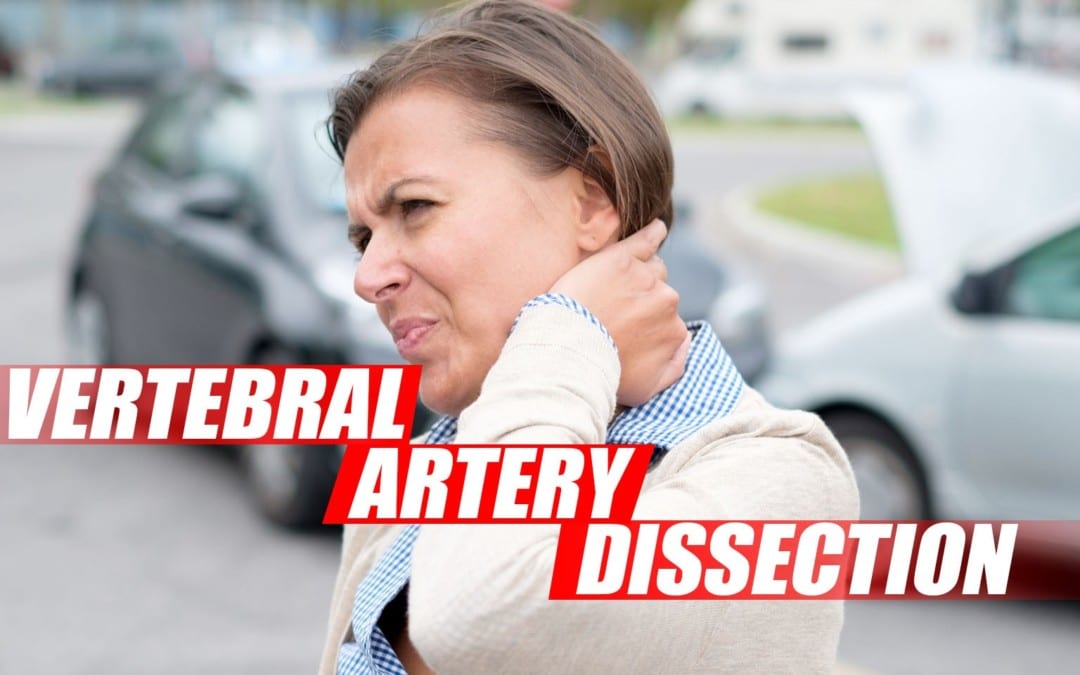 Vertebral Artery Dissection Found During Chiropractic Examination