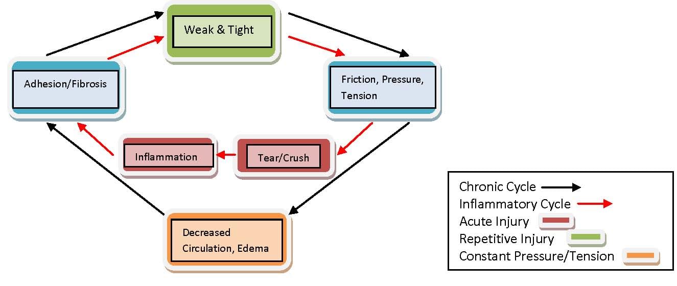 Active Release Technique Diagram 2 | El Paso, TX Chiropractor