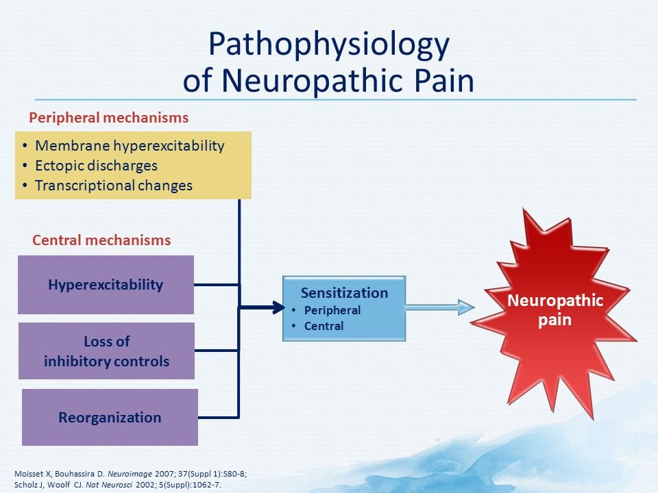 Pathophysiology of Neuropathic Pain Diagram | El Paso, TX Chiropractor