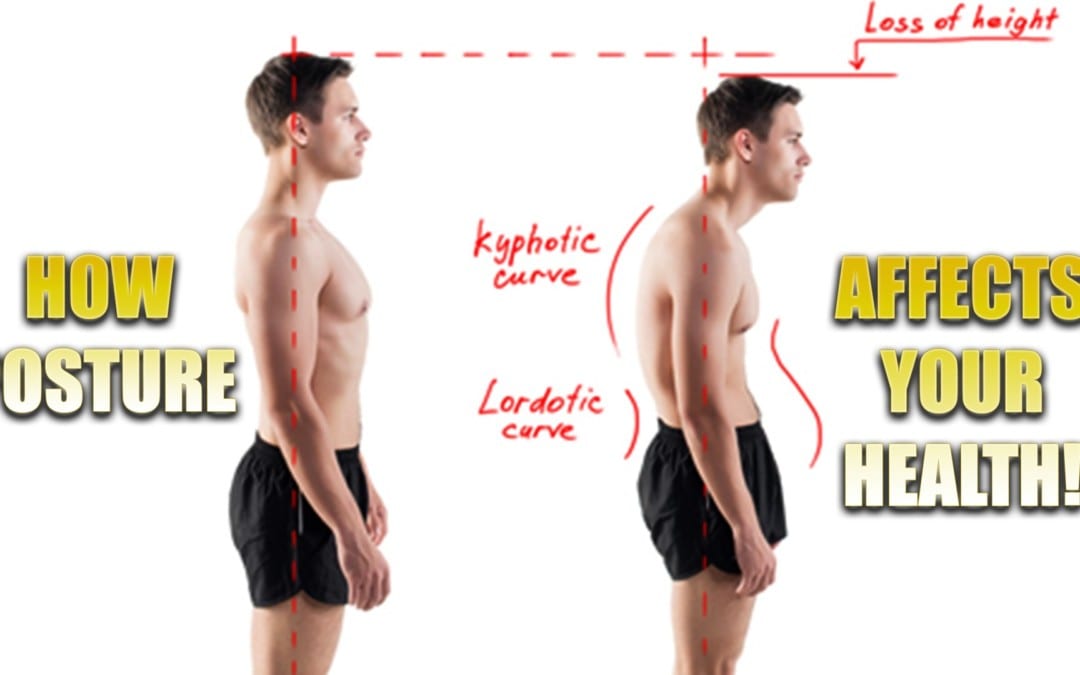 Posture Affects Your Health | El Paso, TX.