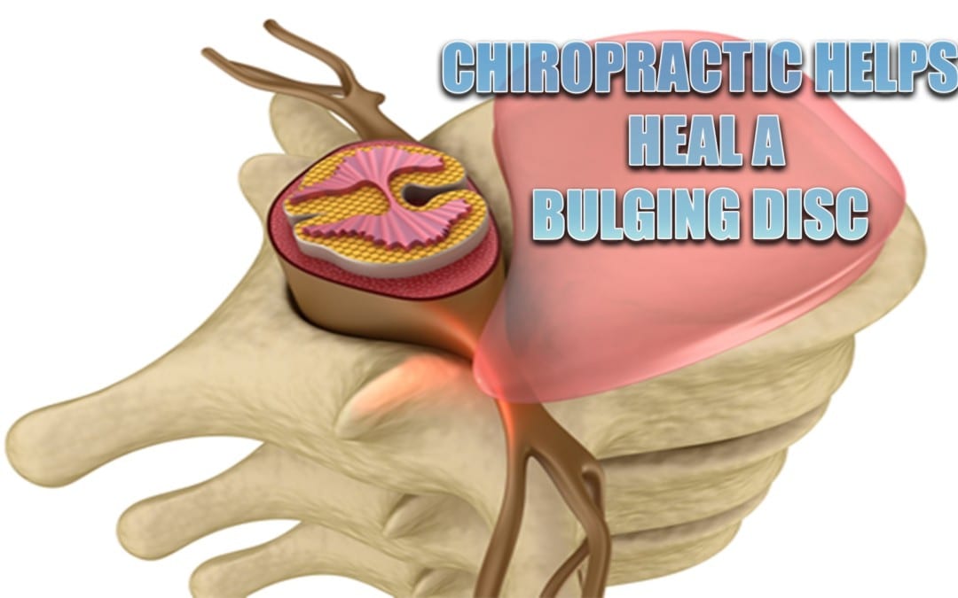 Heal A Bulging Disc Through Chiropractic | El Paso, TX.