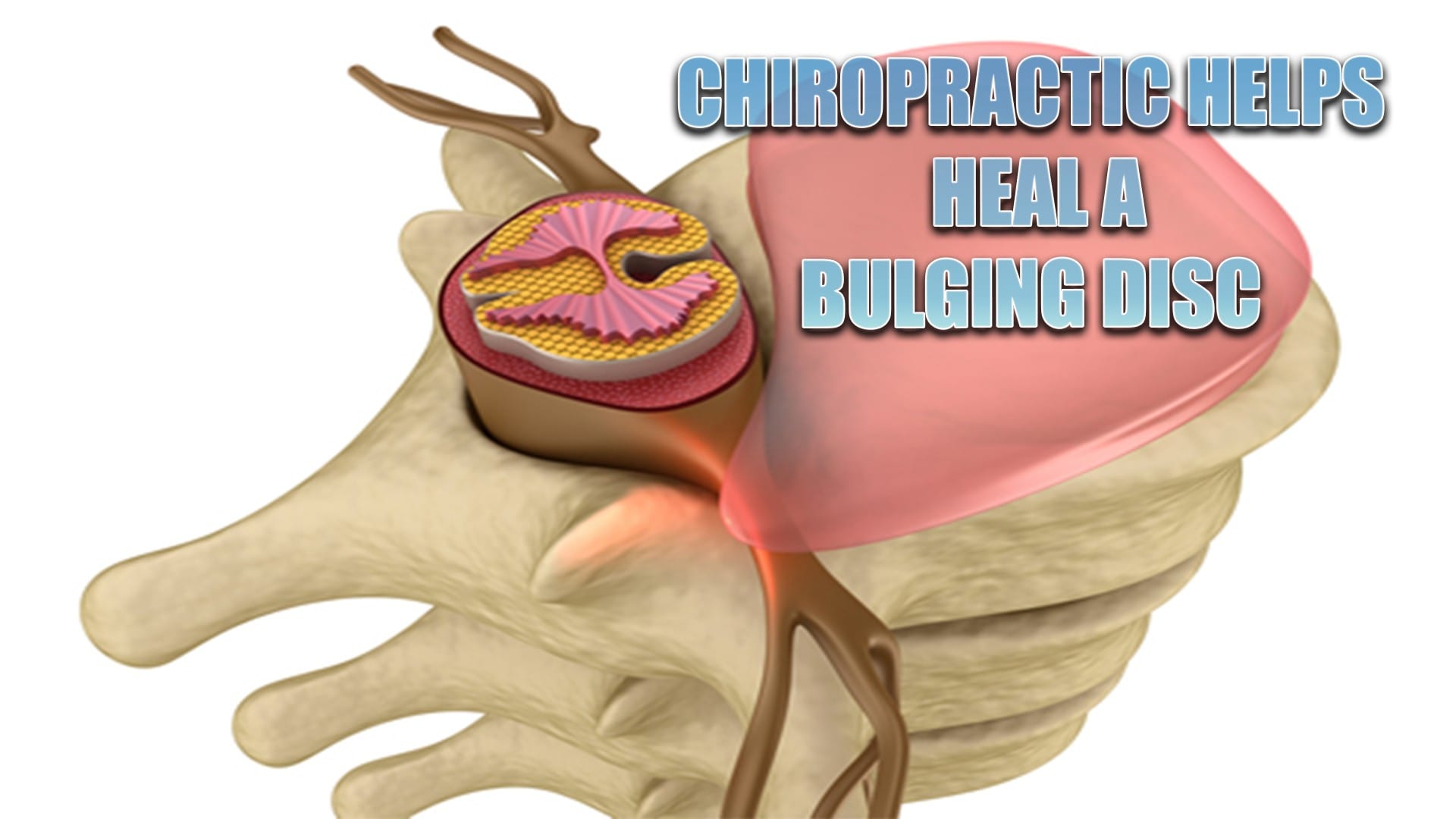 Heal A Bulging Disc Through Chiropractic El Paso, TX.