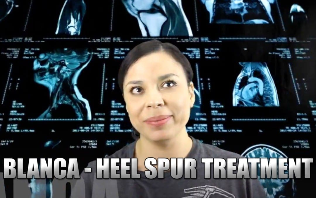 Heel Spur Treatment | Video