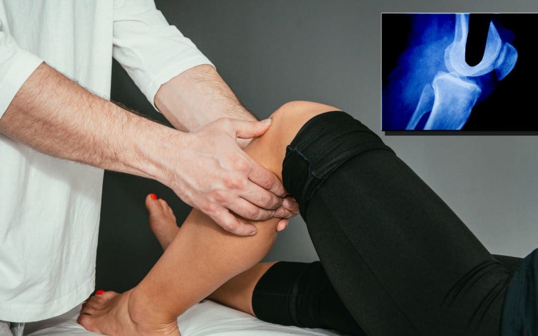 Knee Pain & Acute Trauma Diagnosis Imaging Part II | El Paso, TX