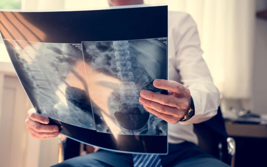 spinal infection diagnostic imaging el paso, tx.