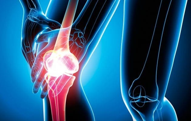 Evaluation of Patients Presenting with Knee Pain: Part I. History, Physical Examination, Radiographs, and Laboratory Tests