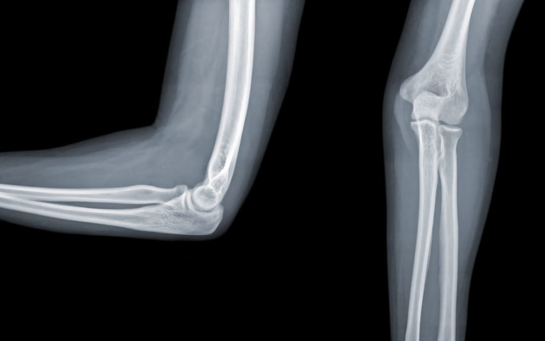 The Elbow: Diagnostic Imaging Approach | El Paso, TX.