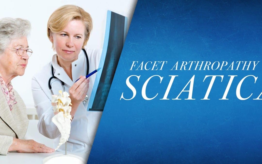 Facet Arthorpathy vs Sciatica | El Paso, TX Chiropractor