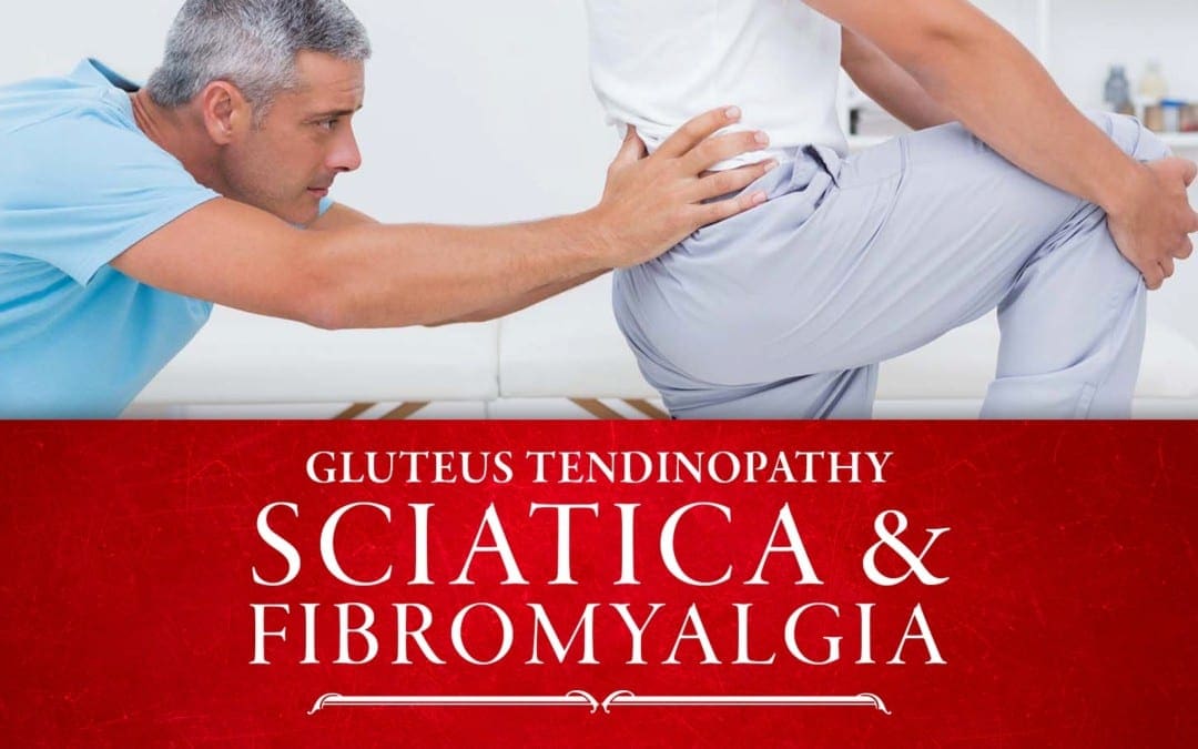 Gluteus Tendinopathy, Sciatica and Fibromyalgia