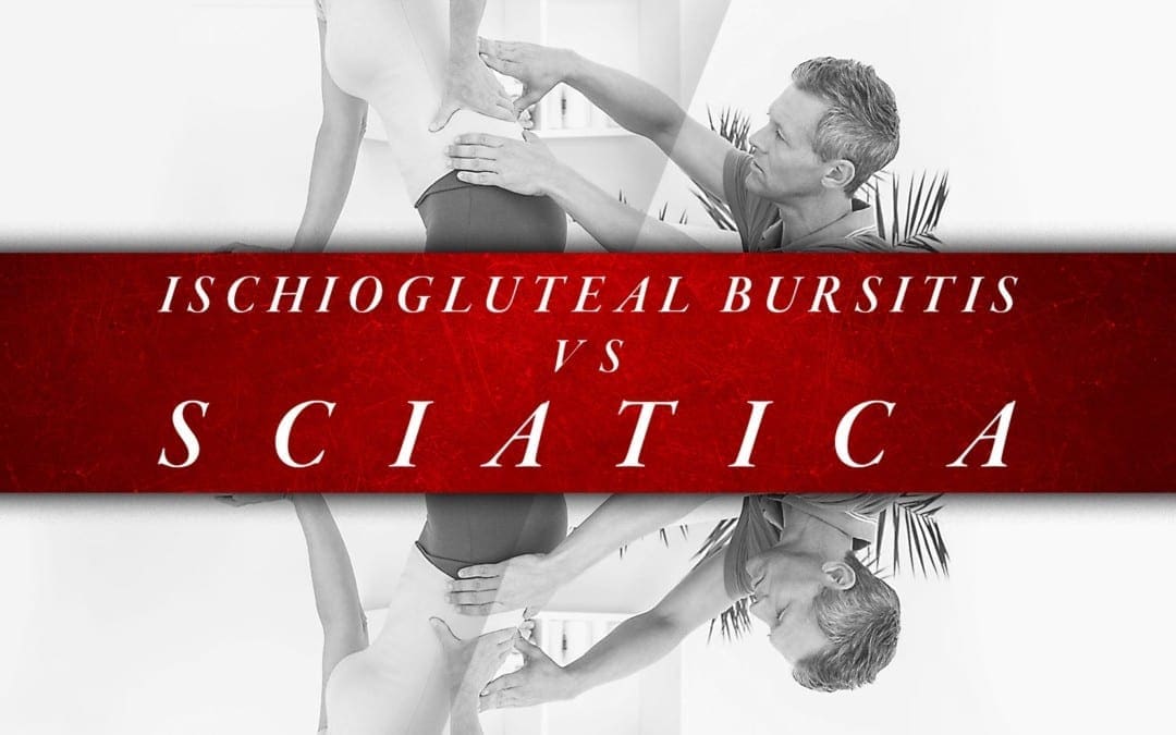 Ischiogluteal Bursitis vs Sciatica | El Paso, TX Chiropractor