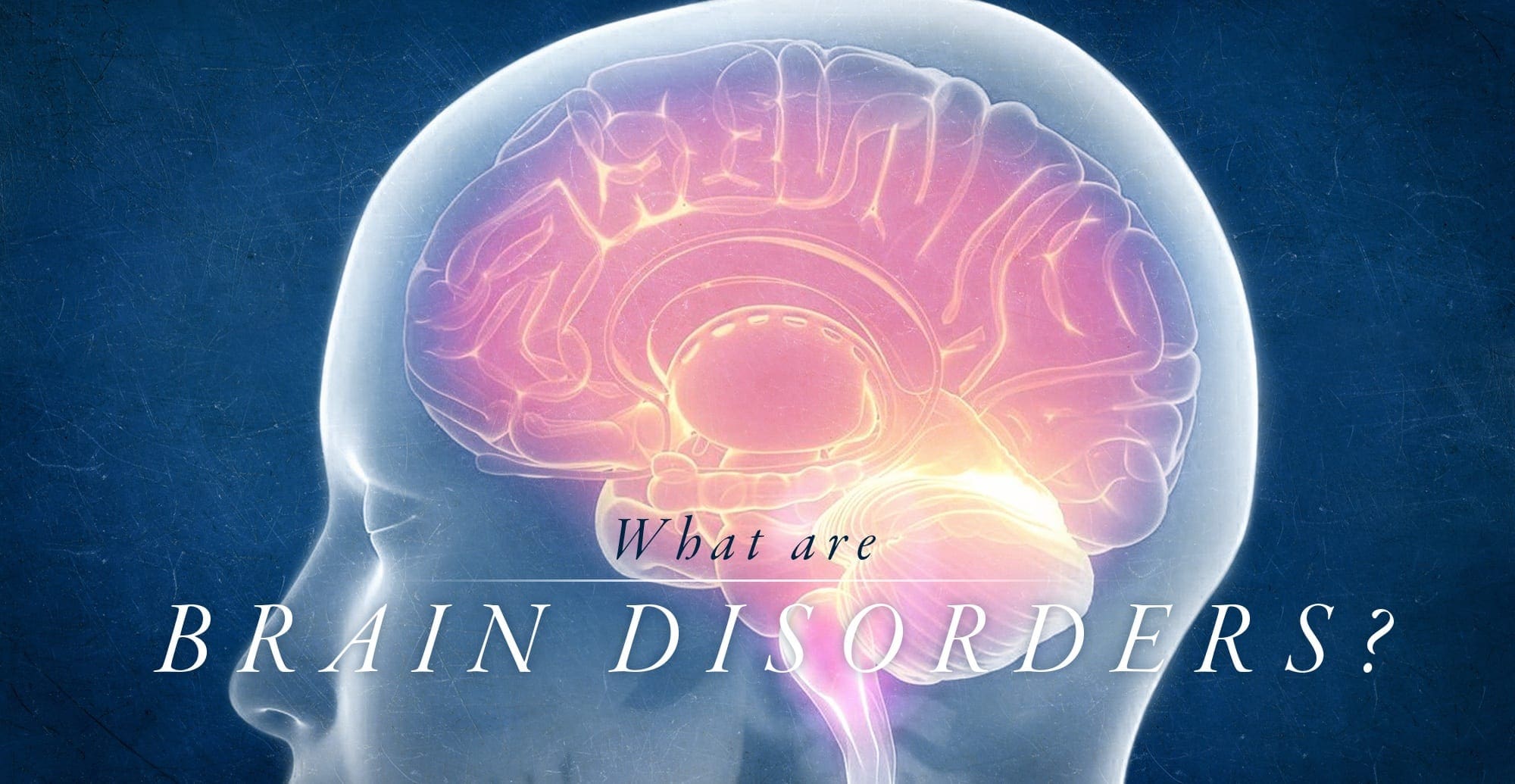 Brain disorder