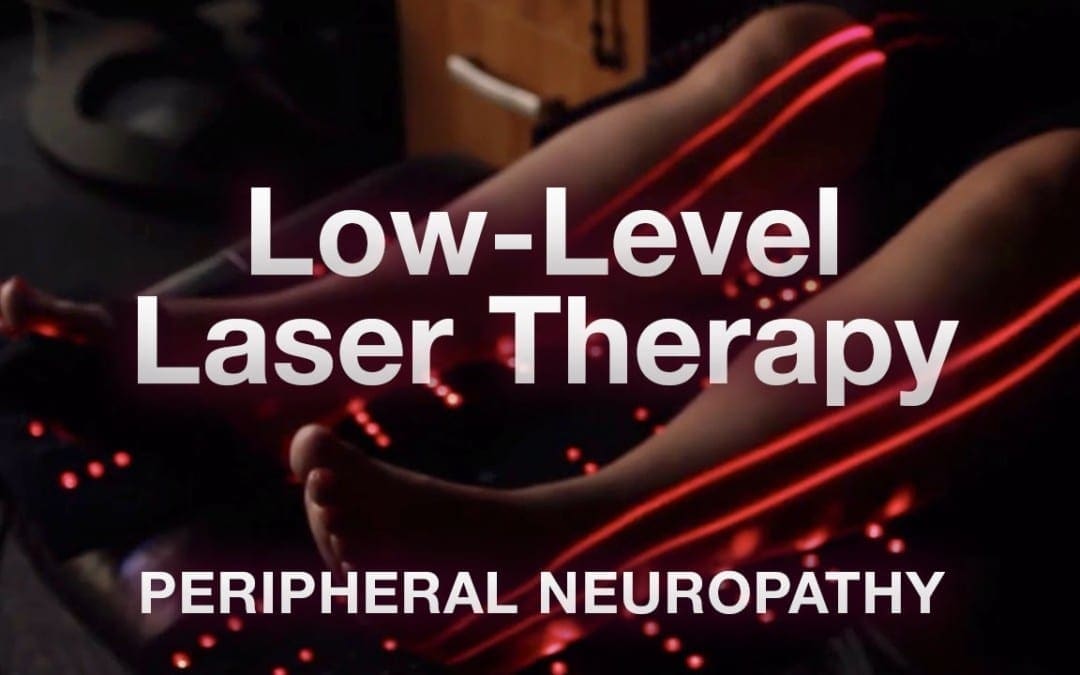 Low-Level Laser Therapy (LLT) for Peripheral Neuropathy El Paso, TX.
