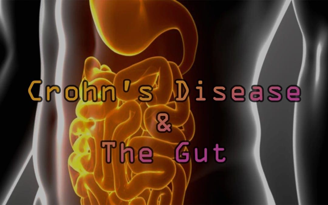 The Critical Link To Crohn’s Disease and The Gut