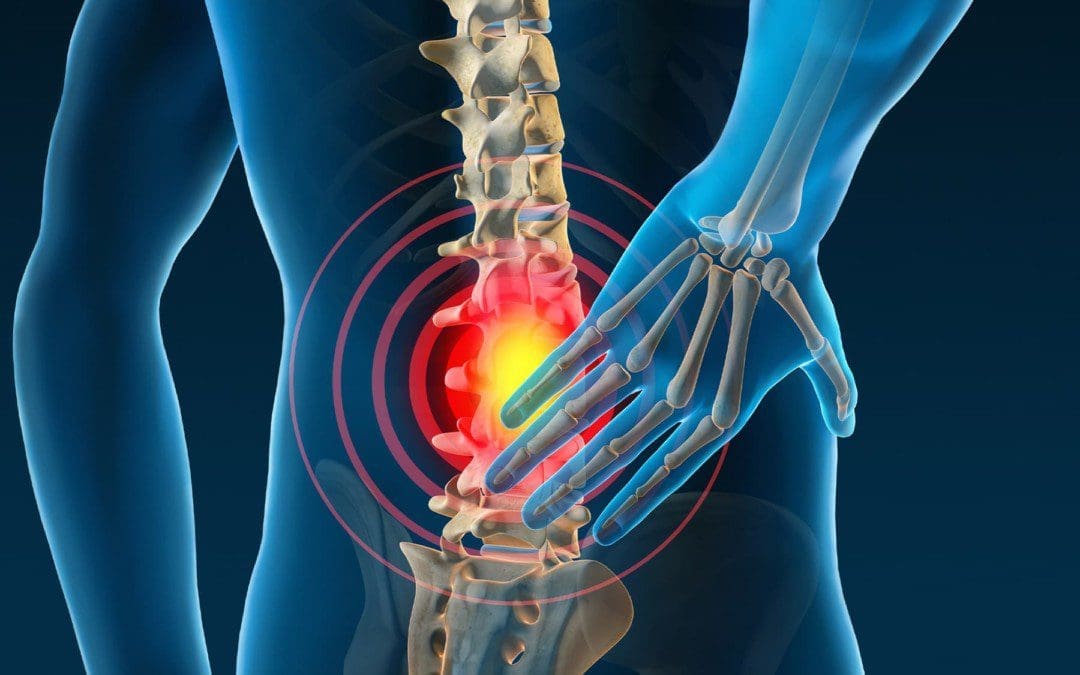 The Effects Of Spinal Decompression For Lumbar Disc Herniation