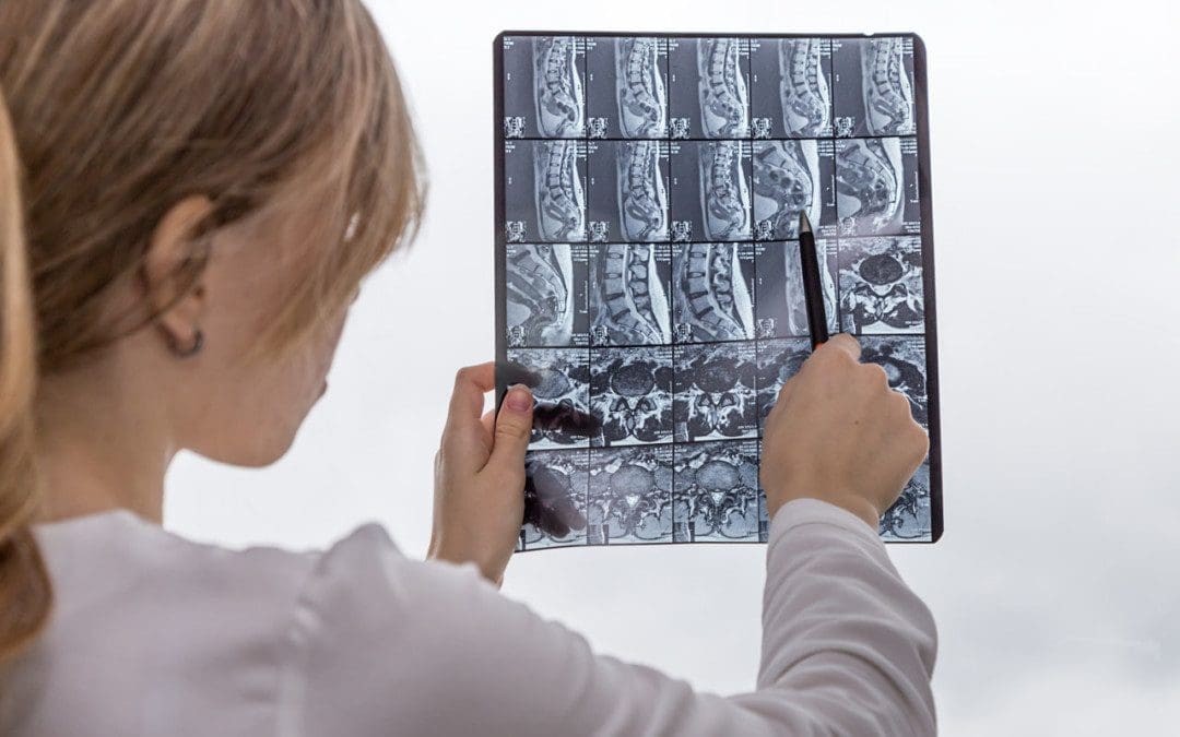 The Definitive Diagnostic Edge: Why El Paso Attorneys Partner with Dr. Alex Jimenez, DC, APRN, FNP-BC for Medico-Legal Causality, Advanced MRI Interpretation, and Unassailable Injury Dating