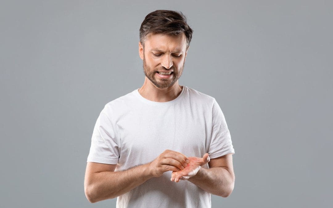 Skin Disorders Ankylosing Spondylitis Back Clinic