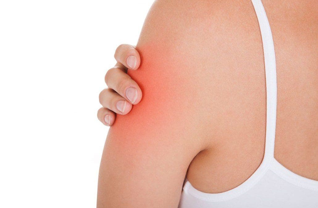 Trigger Points Affecting The Upper Arm Muscles