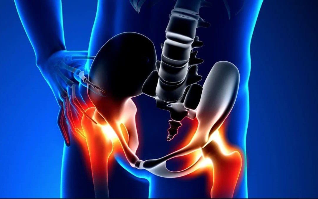 Assessing Hip Flexors With MET Therapy