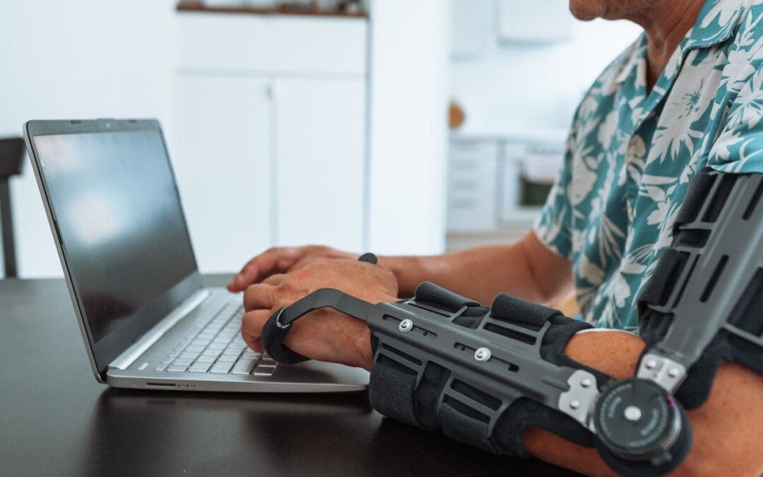 Dislocated Elbow: Causes and Treatment Options