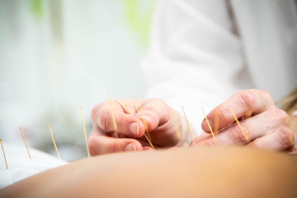 The Power of Acupuncture for Piriformis Syndrome