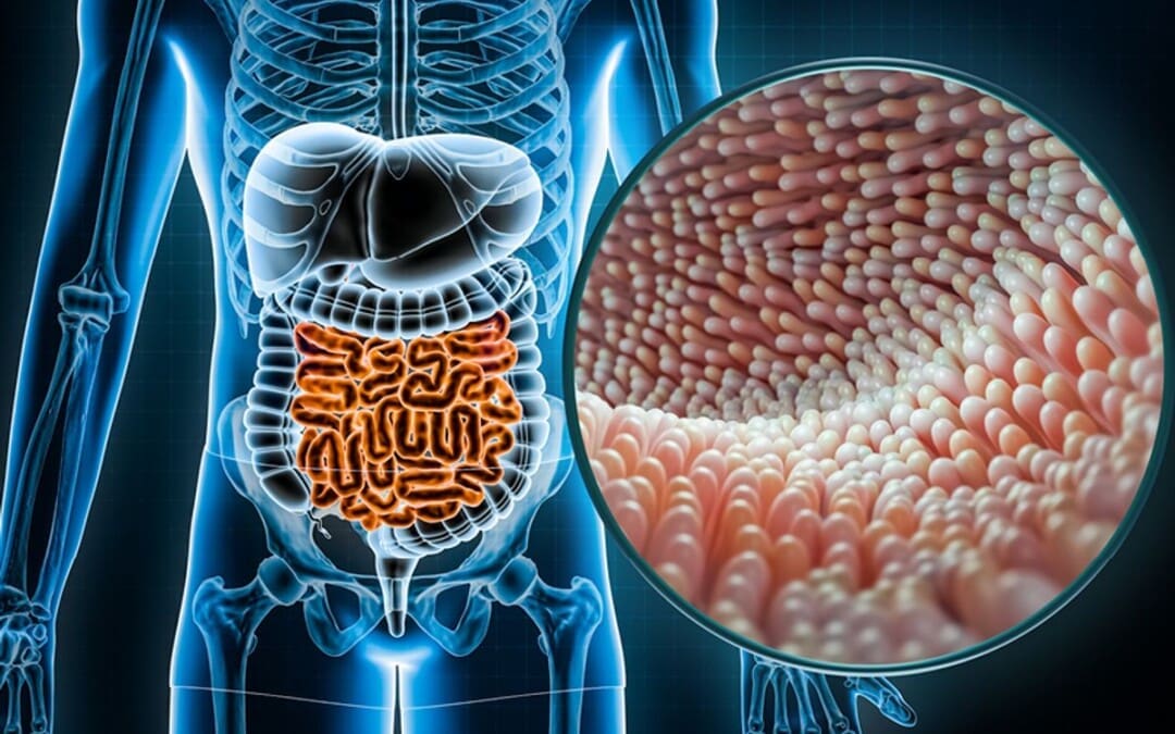 Understanding Electroacupuncture and How It Relieves Gut Inflammation