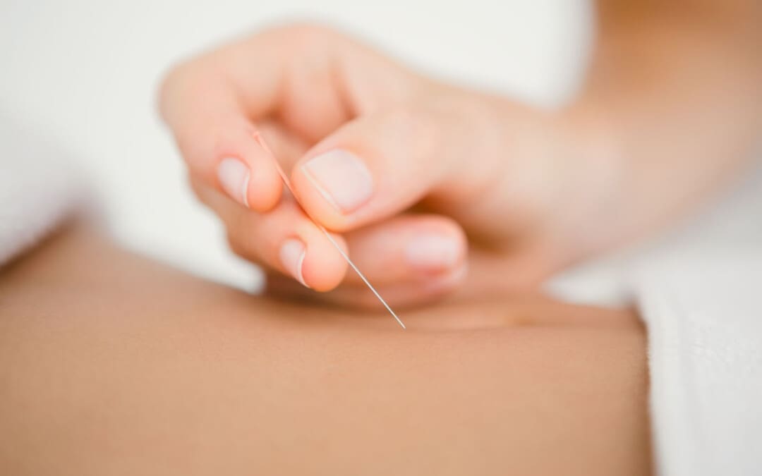 Comprehensive Support Therapies for Endometriosis Management