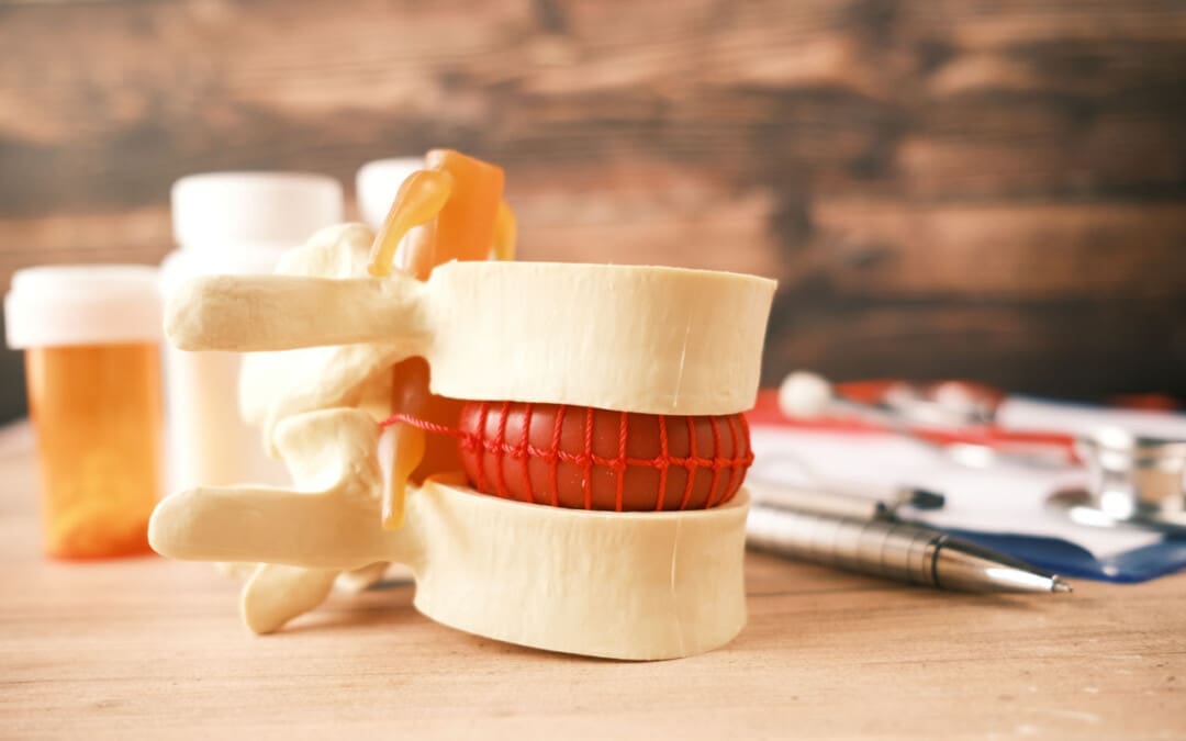 Enhancing Intervertebral Disc Health: Strategies for Well-being