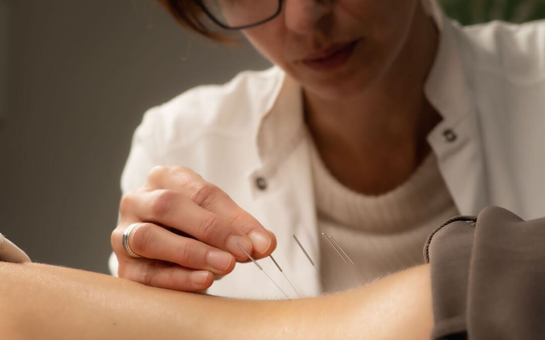 How Acupuncture Can Help with Anxiety and Panic Disorders