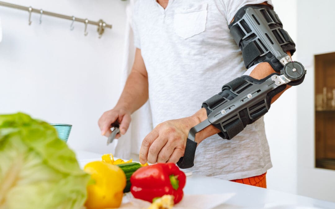 Nutrition for Accident Injuries During Recovery