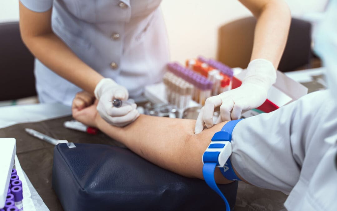 Anti-Inflammatory Diet for Regenerative Injection Recovery