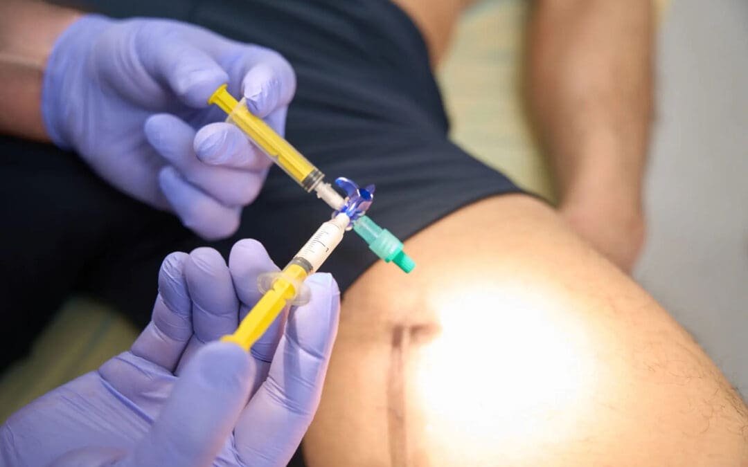 Sports-Related Neuropathic Pain and Chiropractic Care