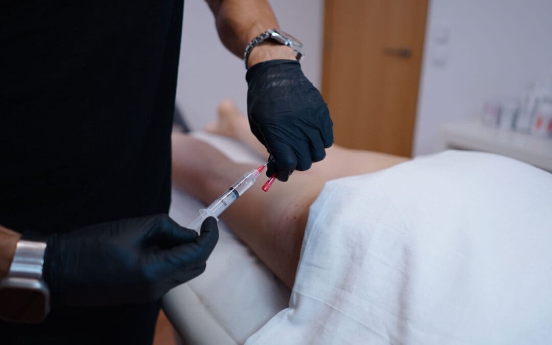 Sports Injury Recovery Using PRF and Chiropractic Care